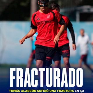 𝑳𝑶𝑺 𝑮𝑨𝑱𝑬𝑺 𝑫𝑬𝑳 𝑶𝑭𝑰𝑪𝑰𝑶 🤕

Tomás Alarcón, mediocampista albo, fue uno de los que entrenó diferenciado durante la semana, pero no por una lesión muscular, sino por una fractura que sufrió en su rostro por un golpe que recibió ante Huachipato.

Fue Fernando Ortiz, DT de Colo-Colo, quien confirmó esto y también dijo que el jugador usó una máscara y logró reintegrarse a los entrenamientos. A pesar de sus molestias, fue citado y estará vs Coquimbo por la Copa de la Liga.

¿Cómo debería formar el mediocampo albo pasa el debut en el nuevo torneo nacional? 👀✍🏻 #RR